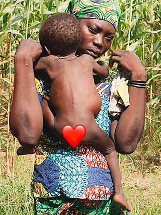Hungersnot Gobo Mutter-Kind-Programm