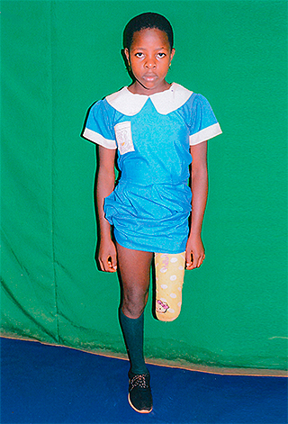 Kinderoperationen Ashia Kamerun