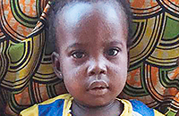 Analatresie Fehlbildung Darm Kamerun Kinderoperation