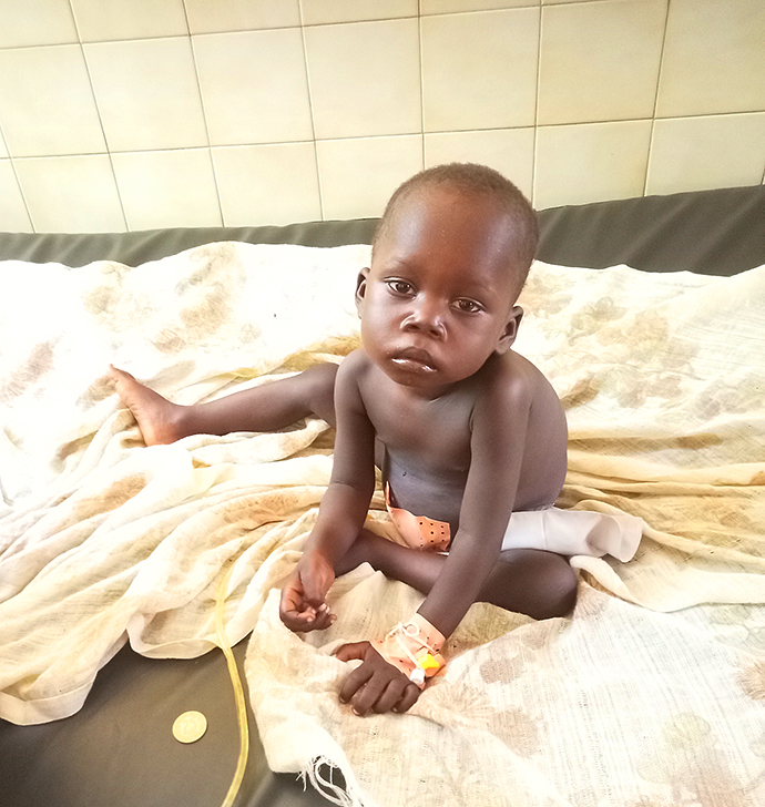 Hischsprung Krankheit Kind Kamerun