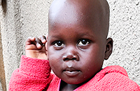 Hirschsprung Kamerun Krankheit Kind