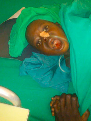 Lymphangiom Krankheit Kind Kamerun