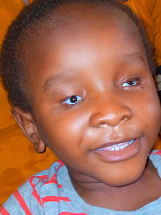 Kind mit Glas-Augen Kamerun Afrika