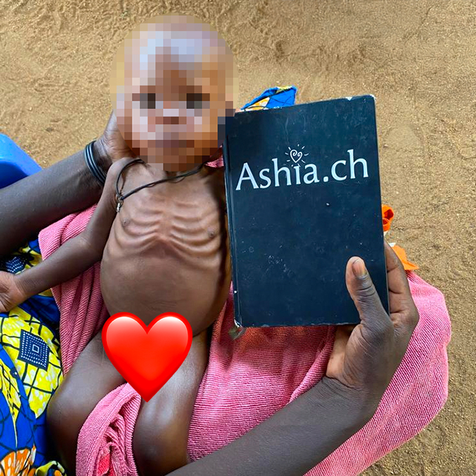 Hunger Hungersnot Humanitäre Hilfe Hungernde Kinder Hungerhilfe Leben retten Kampf gegen den Hunger