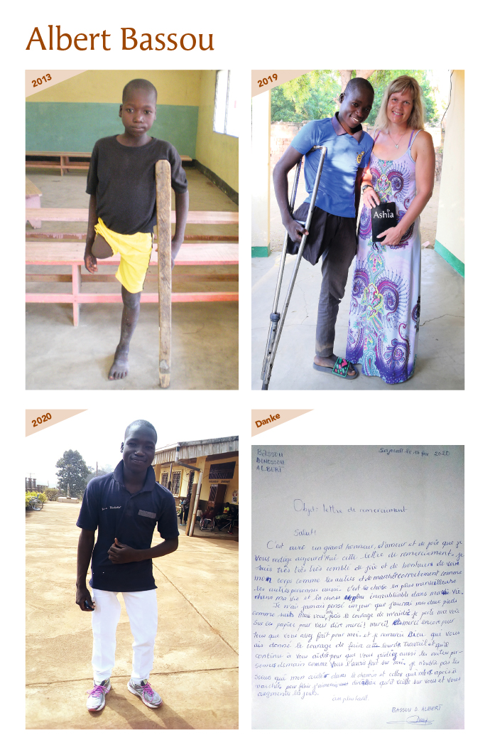 Kinderoperationen Kamerun Prothese Bein