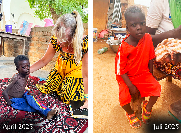 Hungersnot Kinderhilfe Kindern helfen Afrika Krankheit Nothilfe