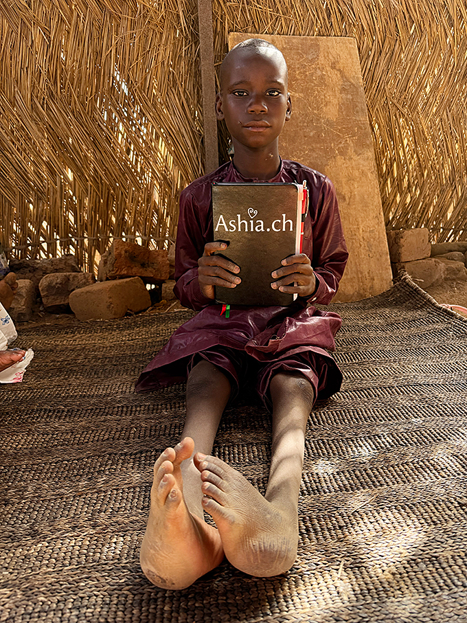 Ashia Kamerun Kinderhilfswerk Reisebericht Kinderoperation