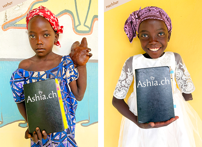 Kindern in Afrika Operation Spitalbehandlung finanzieren Handtumor