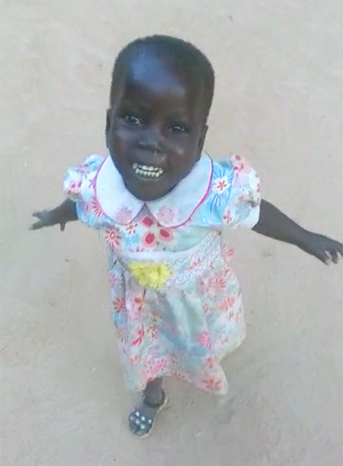 Patenkind Kamerun mangelernährtes Mädchen