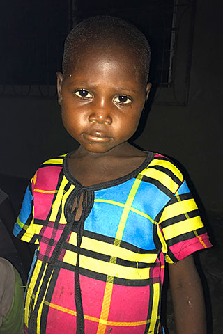 unterenährtes Patenkind Kamerun