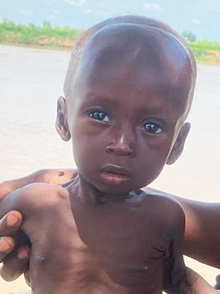 Hungersnot Kindstod Kamerun
