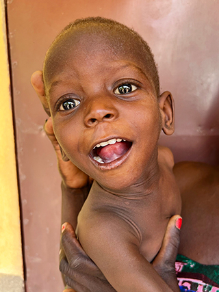 Hungersnot Kamerun