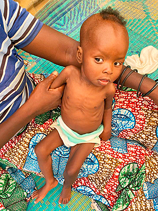 Hungersnot Kamerun