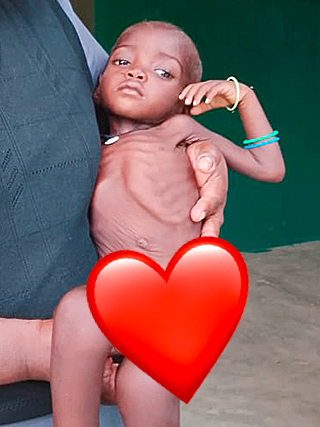 Hungersnot Kindstod Kamerun