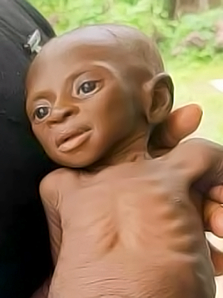 Hungersnot Kamerun