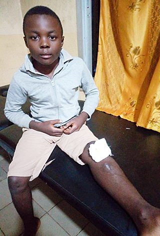 Kinderoperationen Ashia Kamerun