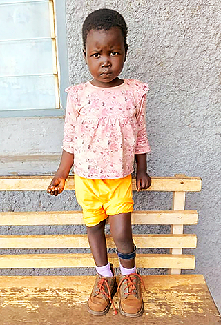 Kinderoperationen Ashia Kamerun