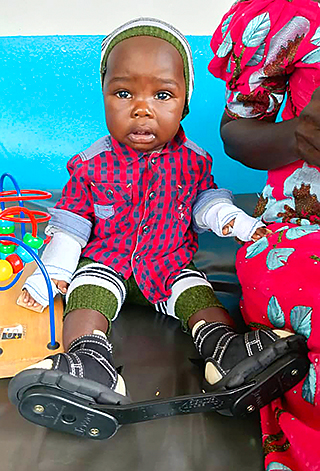 Kinderoperationen Ashia Kamerun