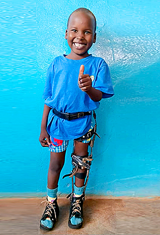 Kinderoperationen Ashia Kamerun