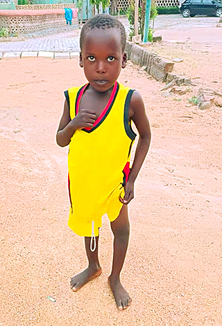 Kinderoperationen Ashia Kamerun