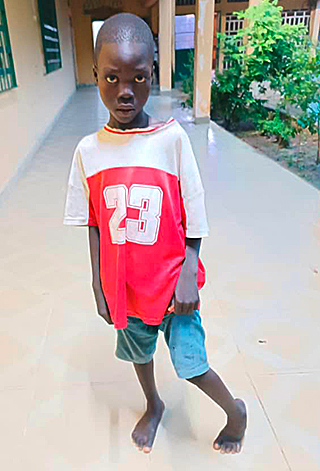 Kinderoperationen Ashia Kamerun