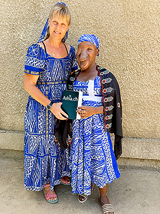 Gesichtstumor Kamerun Kinderoperation
