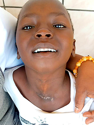 Halsfistel Kinderoperation Kamerun Kinderhilfswerk