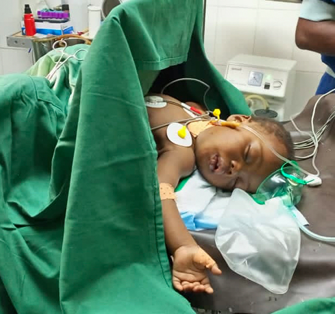Anorektale Fehlbildung Kamerun Kinderoperation